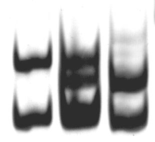 D2S1360 zeigt 3 Allele und weist auf die Entstehung der Triploidie während der maternalen Meiose I hin (a,b,c stellen Arbeitseinheiten dar).