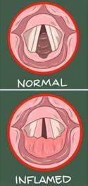 Die Stellknorpel sind für das Öffnen und Schließen zuständig. 3. Nervale Versorgung Die Innervation erfolgt durch den N. laryngeus recurrens. Bei Schädigung kann es zur Stimmbandlähmung kommen. (N.