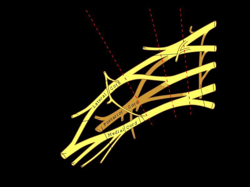 50. Plexus brachialis Plexus sind Geflechte aus ventralen Ästen der Spinalnerven.