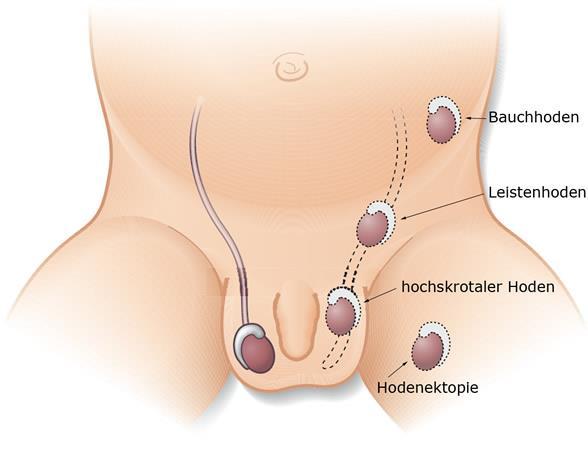 Testis / Prostata / Ductus deferens: Verlauf / Funktion 1.Testis Die eiförmigen Hoden (Testis) sind paarig angelegt und im Hodensack (Skrotum) elastisch aufgehängt.