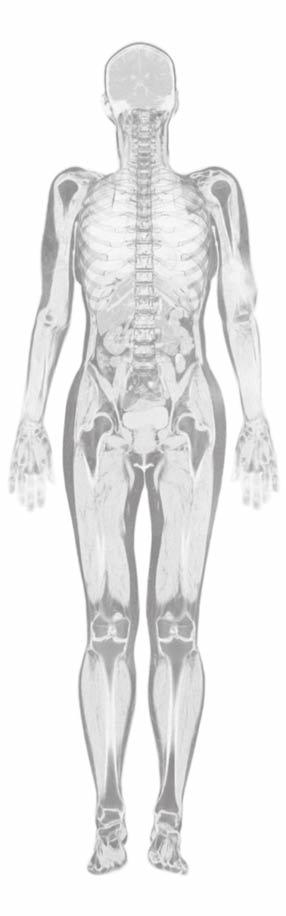 AUFBAU DES KNIEGELENKS Beim Kniegelenk handelt es sich um das größte und komplexeste Gelenk des menschlichen Körpers.
