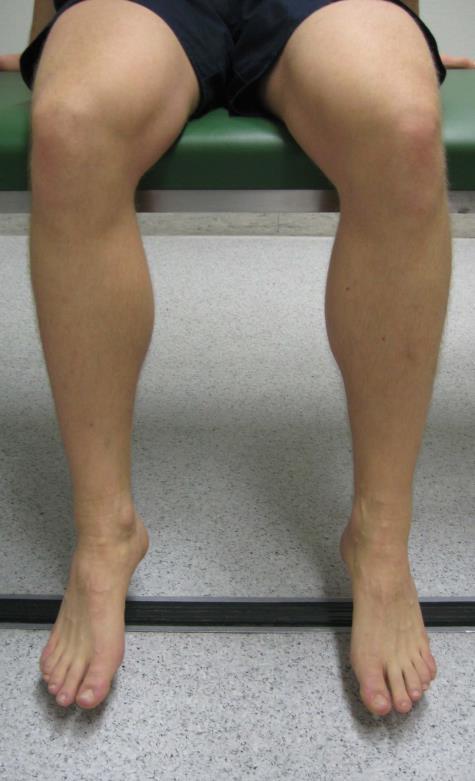 Abbildung 3: Foto aus der Sicht des Untersuchenden. Beurteilung des Verlaufs der Patella bei Kniegelenksflexion und Extension im Sitzen.