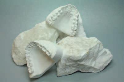 Modellgips, Typ 2 Universal Dental-Alabastergips Hergestellt aus dem reinen Alabaster des Harzgebirges, mit 25 % Hartgipszusatz.
