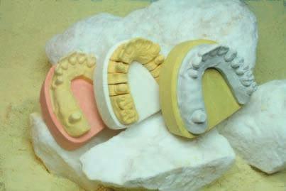 Superhartgips, Typ 4 Sockelgips natur Zum Sockeln von Zahnkränzen, für Vorwälle, Frässockel, zum Fixieren von Unterfütterungen und KFO-Modellen.