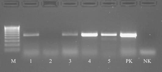 Abbildung A 4: Standard-Single-PCR-Untersuchung von