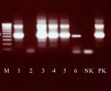ist negativ) Abbildung A 5: Nested-PCR-Untersuchung der