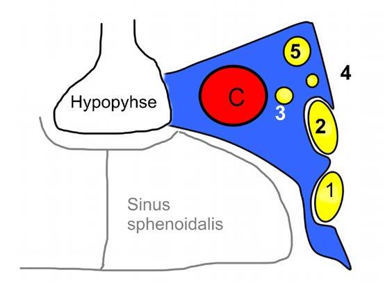 A4. Die Abbildung zeigt einen schematisierten Frontalschnitt, in dem in blau der linke Sinus cavernosus dargestellt ist. Mit C ist die A. carotis interna gekennzeichnet.