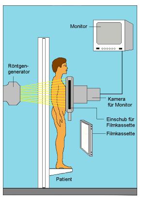 Strahlung Ionisierende