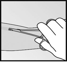 Wenn die Spitze des Implantats nicht sichtbar ist, schieben Sie vorsichtig eine Klemme in die Inzision (Abbildung 15). Nehmen Sie die Klemme in die andere Hand (Abbildung 16).