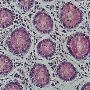 Phosphorwolframhämatoxylin nach Mallory 84-1491-00 Kit Paraldehydfuchsin, nach Gomori 84-1490-00 Kit PAS, nach Hotchkiss Mc Manus 84-1492-00 Kit PAS, nach More-Maronger