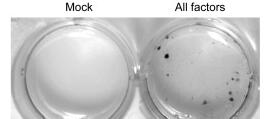 Ausbeute: 0,01% Induction of Pluripotent Stem Cells from Mouse Embryonic and Adult Fibroblast bl