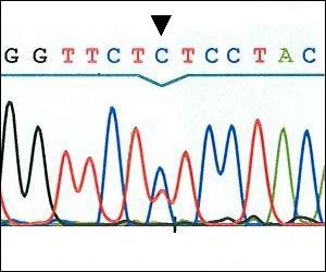 Ergebnisse 41 Abbildung 8: c.127c>t, Der dargestellte Abschnitt der DNA-Sequenz enthält die Veränderung c.127c>t. Der Basenaustausch im zweiten Exon ist durch das schwarze Dreieck markiert.