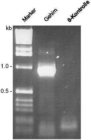 Ergebnisse 45 sequenziert. Die Sequenzierung zeigte, dass es sich bei dem Insert um die 957 bp große kodierende Sequenz der Variante 1 des ZFYVE27-Gens handelt (Genbank Nummer AK097945).