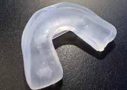 bei sehr langen Frontzähnen, durch Optimierung der Zahneinfassung mit dem thermoplastischen Schalenfüllmaterial auf einfache Weise wie folgt verbessern: Dazu wird das