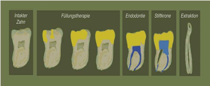 Zahnärztliche Hintergrundinformationen Speicheldrüsen anatomische Strukturen Hydrogencarbonat Funktion: Neutralisation von Säuren, die aus Plaquebakterien gebildet