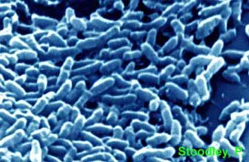 Wundinfektion Jede chronische Wunde ist bakteriell kolonisiert Pseudomonas aeurginosa, beta-hämolytische Streptokokken: Heilungsverzögerung