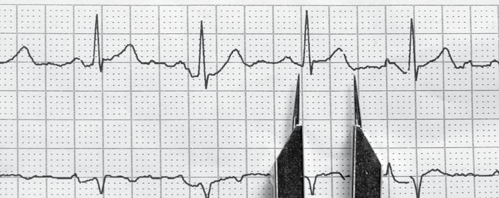 04 Der Herzmuskel in Aktion - EKG Aufgabe: Messen Sie Ihren Herzrhythmus im Ruhezustand, dann noch einmal nachdem Sie sich körperlich betätigt haben (z.b. nach 15-20 Kniebeugen).