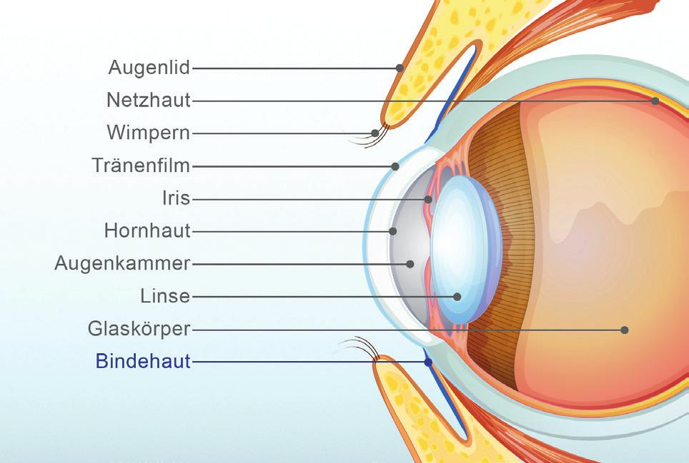 5 Querschnitt des Auges Welche Arten von Bindehautentzündung gibt es?