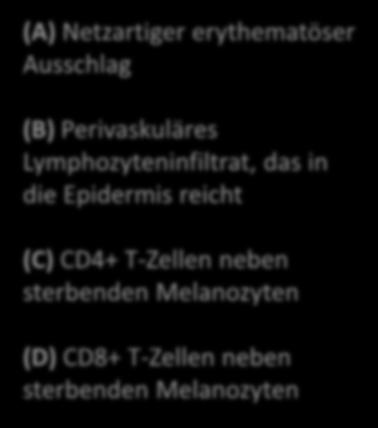 Epidermis reicht (C) CD4+