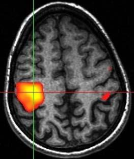 Funktionelle Bildgebung Funktionelle Bildgebung = fmrt = Darstellung von Hirnfunktion Grundidee für fmrt Experimente: - aktive Hirnregionen benötigen mehr