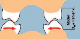 Interaktive Fortbildung Abb. 1a: Maximale Interkuspidation im Munde des Patienten. Abb. 1b: Fehlerhaft erhöhte Vertikaldimension der Modelle durch die Verwindung des Unterkiefers bei weiter Mundöffnung (Abbildungen nach W.