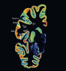Komplizierter als gedacht Sprachregionen im Gehirn des Menschen Neue Erkenntnisse über eine seit langem bekannte Struktur im Gehirn veröffentlichten Prof.