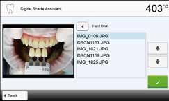 5.7 Digital Shade Assistant (DSA)-Funktion Der Programat P710 verfügt über eine Funktion zur Bestimmung der Zahnfarbe auf Basis von drei ausgewählten Referenzzähnen.