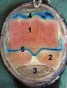 3 Füllung der Bursa podotrochlearis, Querschnitt durch das Huf-, Kron- und Strahlbein, Infiltration des neurovaskulären Bündels (Pfeile).