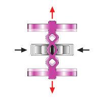 23.2 Die Instrumente 010-00010 Implantat-Schneidezange mit auswechselbaren Mauleinlagen, 22 cm (Abb. 23.13) Implantat-Schneidezange zum Kürzen der Verbindungsstege.