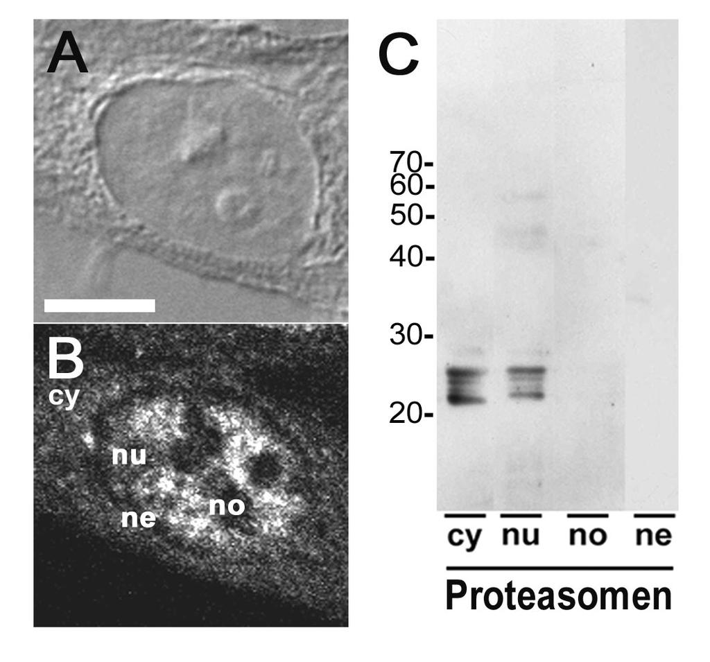 Ergebnisse Abb. 4.1: Subzelluläre Lokalisation der 20S Proteasomen.(A) Differenzielles Inter-ferenzkontrastbild (DIC) einer repräsentativen, humanen HEp-2 Zelle während der Interphase.