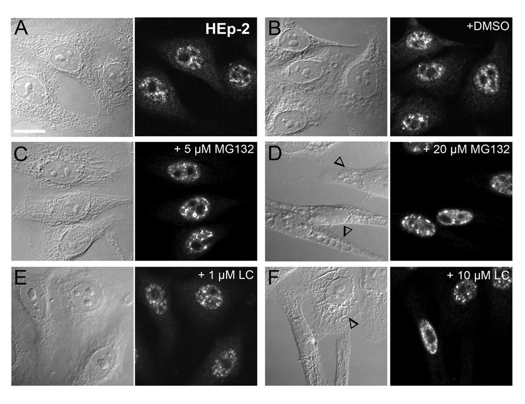 Ergebnisse Abb. 4.2: Subnucleäre Lokalisation der Proteasomen in humanen HEp2- Zellen mit und ohne Proteasominhibitoren.