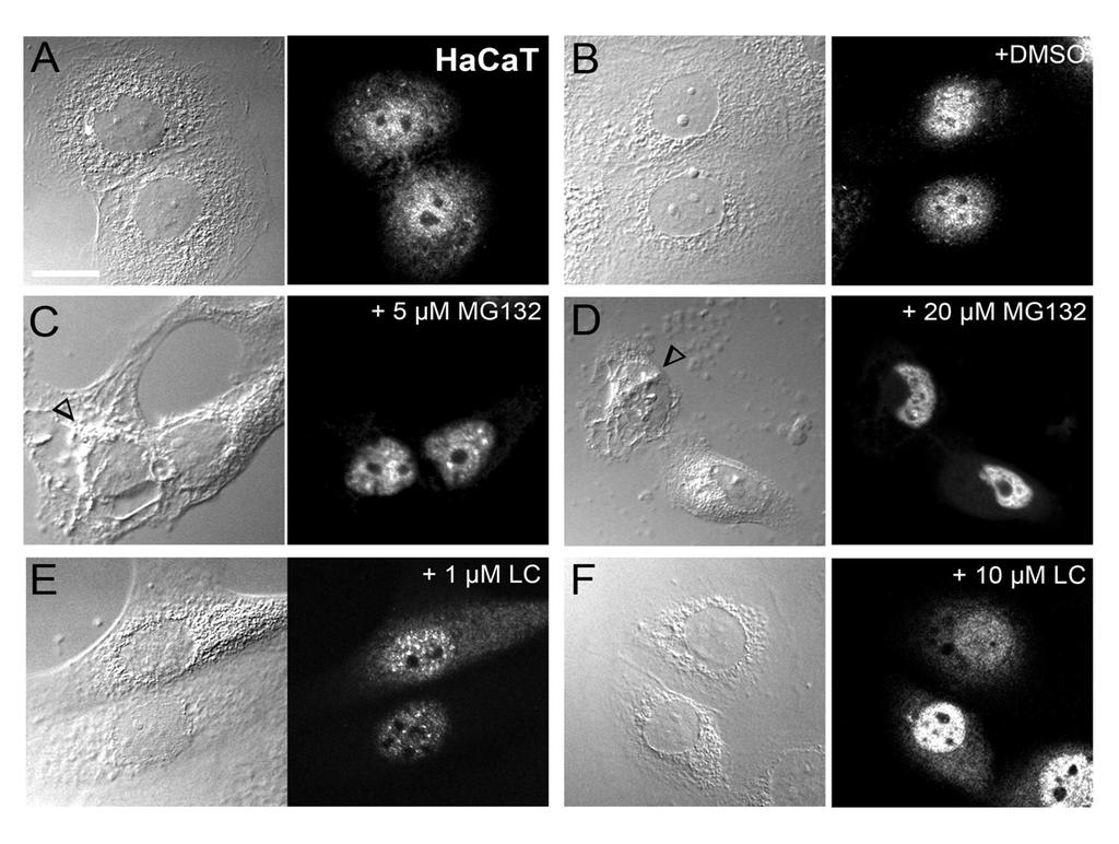 Ergebnisse Abb. 4.3: Subnucleäre Lokalisation der Proteasomen in humanen HaCaT Zellen mit und ohne Proteasominhibition.