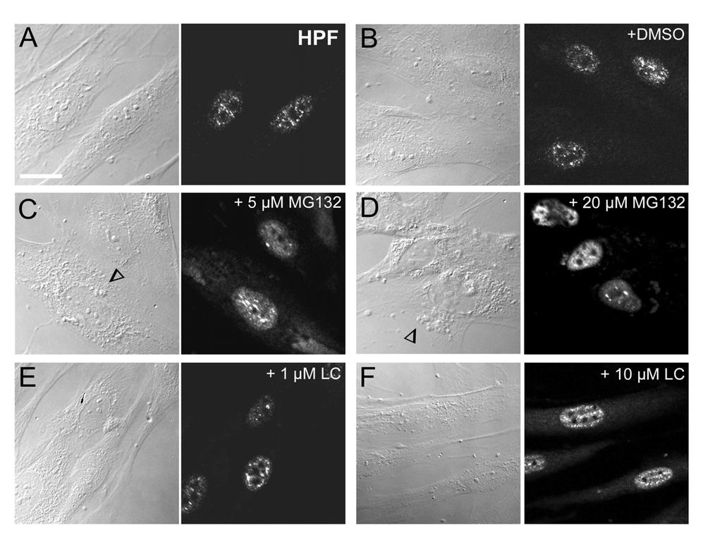 Ergebnisse Abb. 4.4: Subnucleäre Lokalisation der Proteasomen in primären humanen Fibroblasten mit und ohne Proteasominhibition.