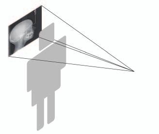 Bilderfassung in einem Augenblick Scansysteme One-Shot -Technologie des CS 9300C Röntgenaufnahme