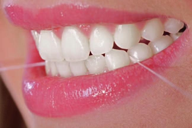 Eine sehr gute Mundhygiene, regelmäßige zahnärztliche Kontrolluntersuchungen, eine abhängig vom individuellen Risiko regelmäßig durchgeführte