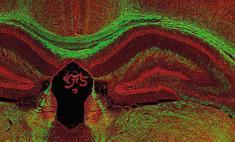 ..44 Das Riechhirn - Wie der Duft ins Gehirn kommt...48 Basalganglien - Nervenknotenpunkte im Gehirn...50 Das Zwischenhirn - Mittendrin statt nur dabei.