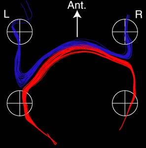 keit drastisch reduziert, da die Wassermoleküle in einem Netzwerk gefangen sind. 15.9.2 Diffusionsanisotropie Das Experiment kann auch benutzt werden, um anisotrope Diffusion zu messen.