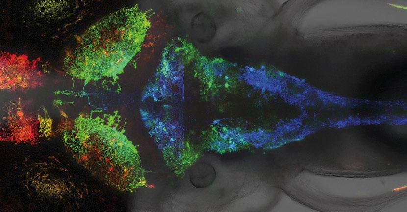 Forschen Zehnmal hochdotierte EU-Förderung Blick auf das Gehirn eines Zebrafischembryos, in dem über ein»transgen«bestimmte Vorläuferzellen fluoreszent markiert wurden.