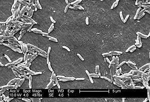 Eigenschaften Fachlicher Input: Campylobacter gramnegatives Bakterium Spirillenartiges gekrümmtes Stäbchen relativ empfindlich >> hohe Ansprüche an ihre Umgebung >> Bildung von Biofilmen