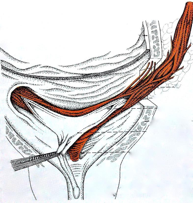 Dorsal, im Fundus der Harnblase liegt das Trigonum vesicae, in dessen beide obere Eckpunkte die Ureterostien mit der dazwischenliegenden Plica interureterica münden.