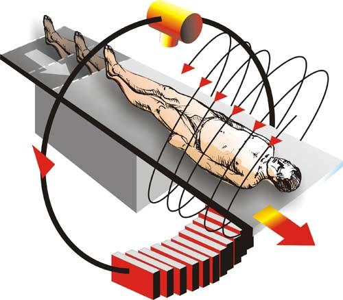 Weitere Entwicklungsschritte: Elektronenstrahl-CT: Verwendung einer Elektronenkanone Fokussierung auf einen Wolframtargetring Erzeugung des erwünschten Röntgenfächers