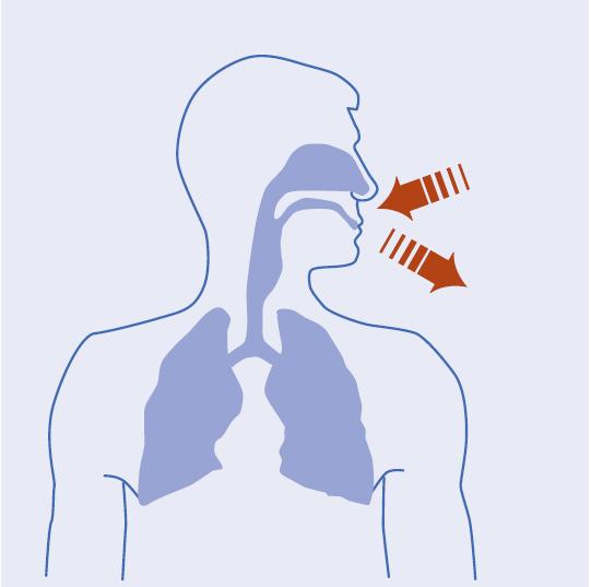 Wie wirkt Radon? Nach dem Rauchen (ca. 85 %) sind Radon und seine Zerfallsprodukte die zweit-häufigste Ursache (ca. 10 %) für Lungenkrebs.