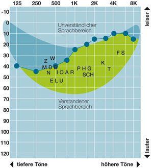 Arten von Hörschädigung Arten von Hörschädigungen Lärmschwerhörigkeit Altersschwerhörigkeit Kombinierte Schwerhörigkeit Schallleitungsschwerhörigkeit