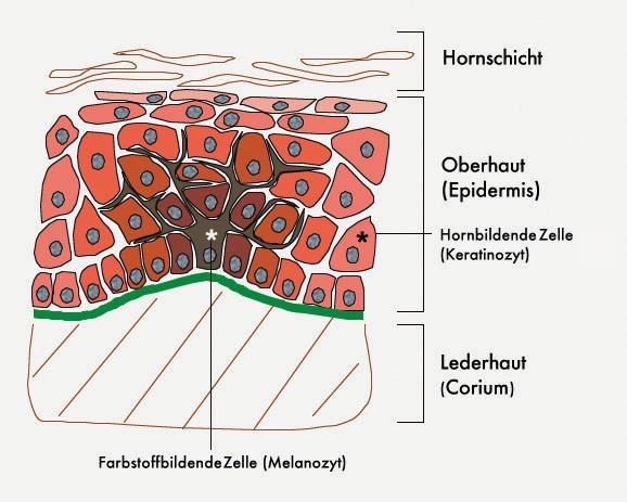 5 Wie gefährlich sind die aktinische Keratose oder ein Spinaliom? Wichtig ist es, diese Hautkrebsformen im frühen Stadium zu erkennen.