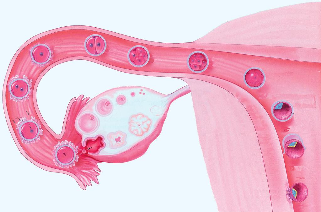 In-Vitro-Fertilisation (IVF) Gründe für die Durchführung einer IVF Als häufige Gründe für die Durchführung einer IVF gelten folgende Befunde: 1. Verschluss, Beschädigung oder Fehlen der Eileiter. 2.