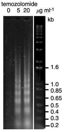 Zelltod Zwei Typen: - Nekrose - Apoptose ( programmierter Zelltod ) Apoptose: stereotyper Vorgang ( Selbstmordprogramm ) Aktivierung spezifischer intrazellulärer Proteasen (Kaspase-Kaskade)