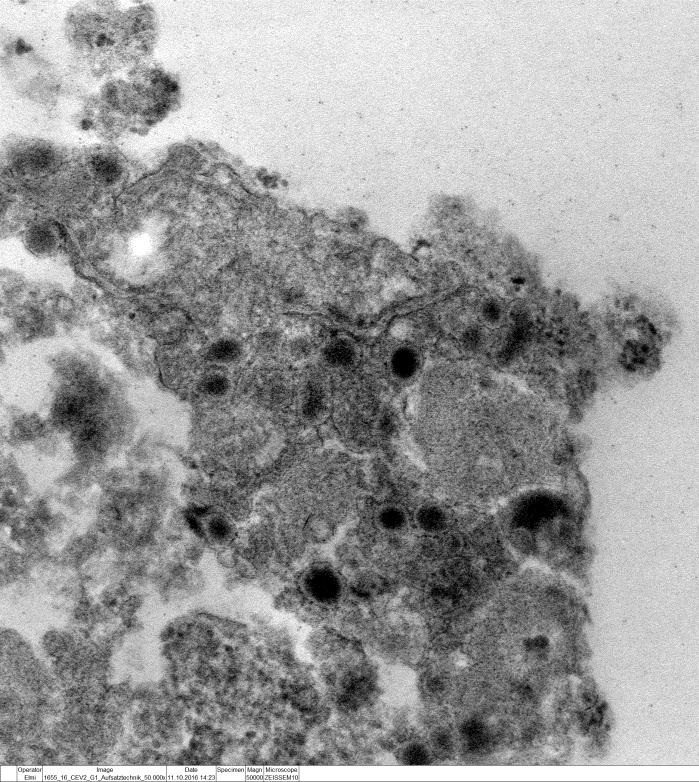Elektronenmikroskopie: Nachweis von Virus-Partikeln Fotos: F.