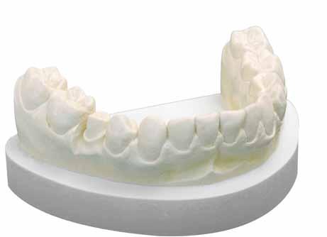 Zahnkranzgips lichtgrau creme RockStar Spezialstumpfgips mit herausragenden Eigenschaften, übertrifft EN ISO 6873, Typ 4. Snap-set-Abbindeverhalten. Scannfähig.