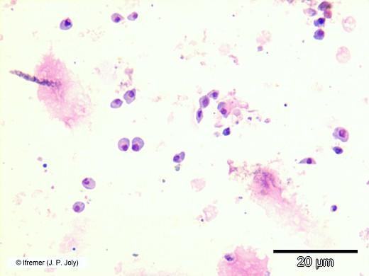 Abb. 2: Abklatsch-Präparat vom Mantel einer Pazifischen Auster mit freien Parasiten (Hemacolor -Färbung) (Bild EU-Referenzlabor Muschelkrankheiten, J-P Joly) 3.3 PCR Zum Nachweis des M.