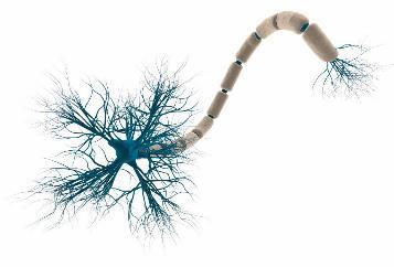 Was sind Neuronen? Neuron (Gehirnzelle) Neuron (Perzeptron) http://www.milad.no/2015/02/07/creating-a-3d-neuron-scene-inblender/ http://www.theprojectspot.